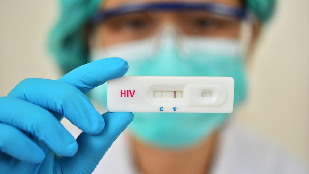 Parintins registra 41 novos casos de HIV